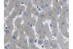 IHC-P analysis of Human Liver Tissue, with DAB staining. (ARPC4 anticorps  (AA 3-165))