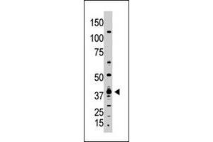 The GDF1 polyclonal antibody  is used in Western blot to detect GDF1 in A-375 cell lysate. (GDF1 anticorps  (N-Term))