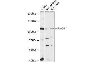 Western blot analysis of extracts of various cell lines, using  antibody (ABIN6129707, ABIN6136907, ABIN6136908 and ABIN6215620) at 1:3000 dilution. (Anoctamin 6 anticorps  (AA 750-830))