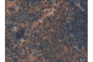 Detection of IL22Ra2 in Rat Spleen Tissue using Polyclonal Antibody to Interleukin 22 Receptor Alpha 2 (IL22Ra2)