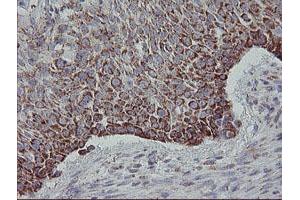 Image no. 5 for anti-Mitochondrial Ribosomal Protein S27 (MRPS27) (AA 151-414) antibody (ABIN1490963)