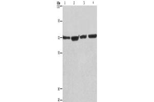 Western Blotting (WB) image for anti-Kruppel-Like Factor 11 (KLF11) antibody (ABIN2428323) (KLF11 anticorps)