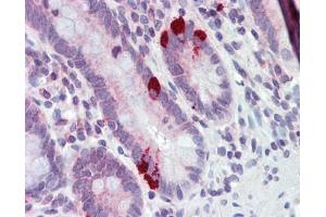 SLC39A5 antibody was used for immunohistochemistry at a concentration of 4-8 ug/ml.