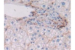 Detection of HLA-DRB1 in Human Liver Tissue using Polyclonal Antibody to HLA Class II Histocompatibility Antigen, DRB1 Beta Chain (HLA-DRB1)