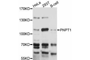 Western blot analysis of extracts of various cell lines, using PNPT1 antibody (ABIN5998548) at 1:3000 dilution. (PNPT1 anticorps)