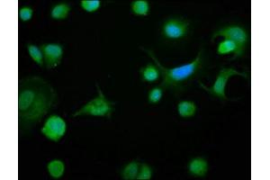 Immunofluorescence staining of MCF-7 cells with ABIN7145294 at 1:133, counter-stained with DAPI.
