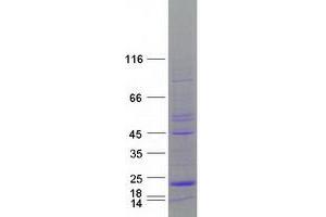 Validation with Western Blot