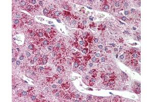 Anti-GLP2R antibody IHC of human adrenal. (GLP2R anticorps  (C-Term))