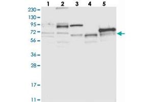 Western blot analysis of Lane 1: RT-4, Lane 2: U-251 MG, Lane 3: Human Plasma, Lane 4: Liver, Lane 5: Tonsil with ABLIM2 polyclonal antibody . (ABLIM2 anticorps)