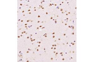 Immunohistochemistry of paraffin embedded rat brain using USP34 (ABIN7076115) at dilution of 1:700 (400x lens)