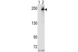 Western blot analysis of ALK antibody and 293 cell lysate (2 ug/lane) either nontransfected (Lane 1) or transiently transfected with the human gene (2). (ALK anticorps  (AA 636-666))