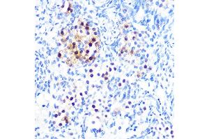 Immunohistochemistry of paraffin-embedded rat ovary using MITF Rabbit mAb (ABIN7268511) at dilution of 1:100 (40x lens).