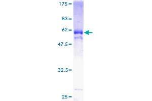 Image no. 1 for Kruppel-Like Factor 6 (KLF6) (AA 1-260) protein (GST tag) (ABIN1308760)