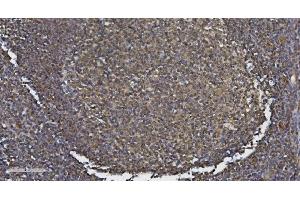 IHC analysis of MEF2C using anti-MEF2C antibody (ABIN6719606). (MEF2C anticorps)