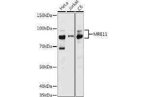 Western blot analysis of extracts of various cell lines, using MRE11 antibody (ABIN6132361, ABIN6143992, ABIN6143993 and ABIN6218236) at 1:1000 dilution. (Mre11 anticorps  (AA 1-205))