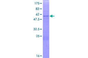 Image no. 1 for Phytanoyl-CoA Dioxygenase Domain Containing 1 (PHYHD1) (AA 1-297) protein (GST tag) (ABIN1314957)