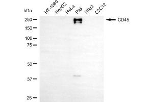 Western blotting analysis using CD45 antibody (ABIN7800044).