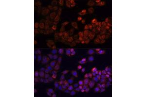 Immunofluorescence analysis of HeLa cells using PTK2 antibody.