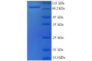 SDS-PAGE (SDS) image for Set1/Ash2 Histone Methyltransferase Complex Subunit ASH2 (ASH2L) (AA 1-534), (Isoform 3) protein (His-SUMO Tag) (ABIN5711897) (ASH2L Protein (AA 1-534, Isoform 3) (His-SUMO Tag))