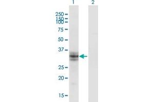Western Blot analysis of B3GALT6 expression in transfected 293T cell line by B3GALT6 monoclonal antibody (M06), clone 3E5. (B3GALT6 anticorps  (AA 229-329))