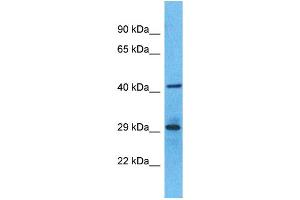 Western Blotting (WB) image for anti-Olfactory Receptor, Family 6, Subfamily S, Member 1 (OR6S1) (C-Term) antibody (ABIN2791769)