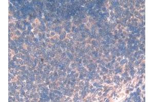 Detection of CXCL7 in Rat Spleen Tissue using Polyclonal Antibody to Chemokine (C-X-C motif) ligand 7 ( CXCL7) (CXCL7 anticorps  (AA 46-107))