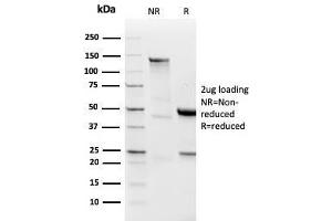 anti-IgL antibody