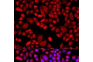 Immunofluorescence analysis of A549 cells using ARPC3 Polyclonal Antibody (ARPC3 anticorps)
