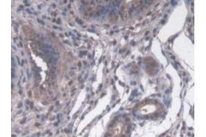 Detection of CYP-40 in Mouse Uterus Tissue using Polyclonal Antibody to Cyclophilin 40 (CYP-40) (PPID anticorps  (AA 9-189))