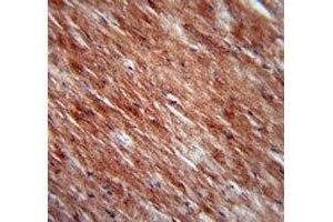 IL-2 antibody immunohistochemistry analysis in formalin fixed and paraffin embedded mouse heart tissue.