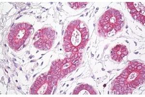 Anti-ETA antibody IHC staining of human breast. (Endothelin-1 Receptor anticorps  (AA 378-427))