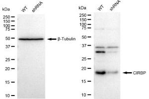 Western blotting analysis using CIRBP antibody (ABIN7798120). (Recombinant CIRBP anticorps)