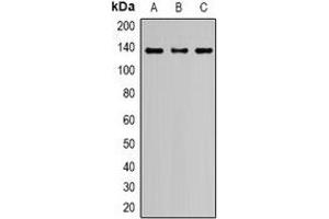 Western blot analysis of Nephrin expression in HeLa (A), HEK293T (B), PC12 (C) whole cell lysates. (Nephrin anticorps  (C-Term))