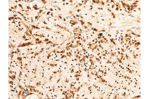 ABIN6267251 at 1/100 staining rat appendiceal tissue sections by IHC-P.