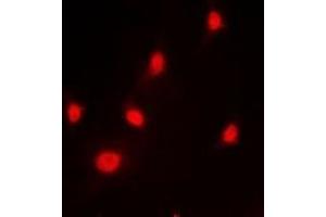 Immunofluorescent analysis of hnRNP L staining in HeLa cells. (HNRNPL anticorps)
