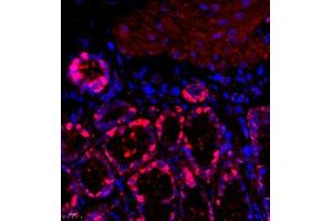 Immunofluorescence of paraffin embedded rat colon using Thymosin (ABIN7075306) at dilution of 1:1500 (400x lens)