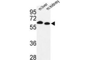 Western Blotting (WB) image for anti-Proline Dehydrogenase (Oxidase) 1 (PRODH) antibody (ABIN3003837) (PRODH anticorps)