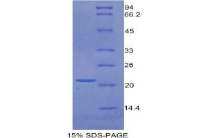 SDS-PAGE of Protein Standard from the Kit  (Highly purified E. (GAS6 Kit ELISA)