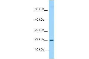 Host: Rabbit Target Name: Etv3l Sample Type: Rat Thymus lysates Antibody Dilution: 1. (ETV3L anticorps  (Middle Region))