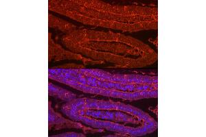anti-Lectin, Galactoside-Binding, Soluble, 2 (LGALS2) (AA 1-132) antibody
