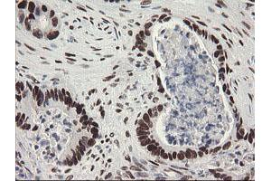 Image no. 3 for anti-Transducin-Like Enhancer of Split 1 (E(sp1) Homolog, Drosophila) (TLE1) (AA 180-460) antibody (ABIN1491049)