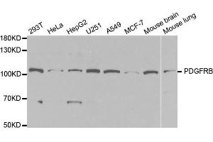 Western blot analysis of extracts of various cell lines, using PDGFRB antibody. (PDGFRB anticorps  (AA 887-1106))