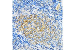 Immunohistochemistry of paraffin-embedded rat ovary using SIRT2 antibody (ABIN5970103) at dilution of 1/100 (40x lens). (SIRT2 anticorps)