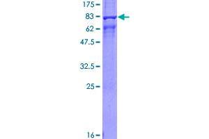 Image no. 1 for Arrestin, beta 1 (ARRB1) (AA 1-418) protein (GST tag) (ABIN1345722)
