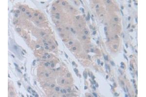 Detection of RARa in Human Stomach Tissue using Polyclonal Antibody to Retinoic Acid Receptor Alpha (RARa)