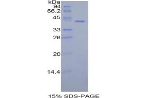 SDS-PAGE analysis of Human HIST1H2AH Protein. (HIST1H2AH Protéine)