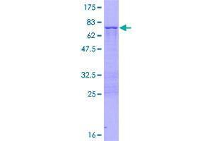 Image no. 1 for Zinc Finger Protein 385A (ZNF385A) (AA 1-366) protein (GST tag) (ABIN1326152)