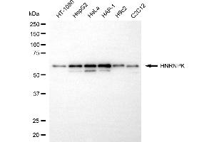 Western blotting analysis using HNRNPK antibody (ABIN7798899).