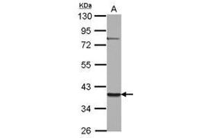 Image no. 1 for anti-Zinc Finger Protein 302 (ZNF302) (AA 1-178) antibody (ABIN1501835) (ZNF302 anticorps  (AA 1-178))