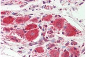 Human Ganglion Cells (Prostate): Formalin-Fixed, Paraffin-Embedded (FFPE)